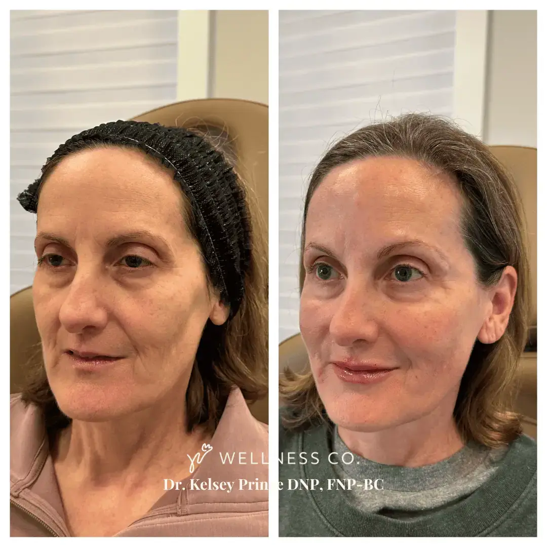 Before-Afters-7.webp