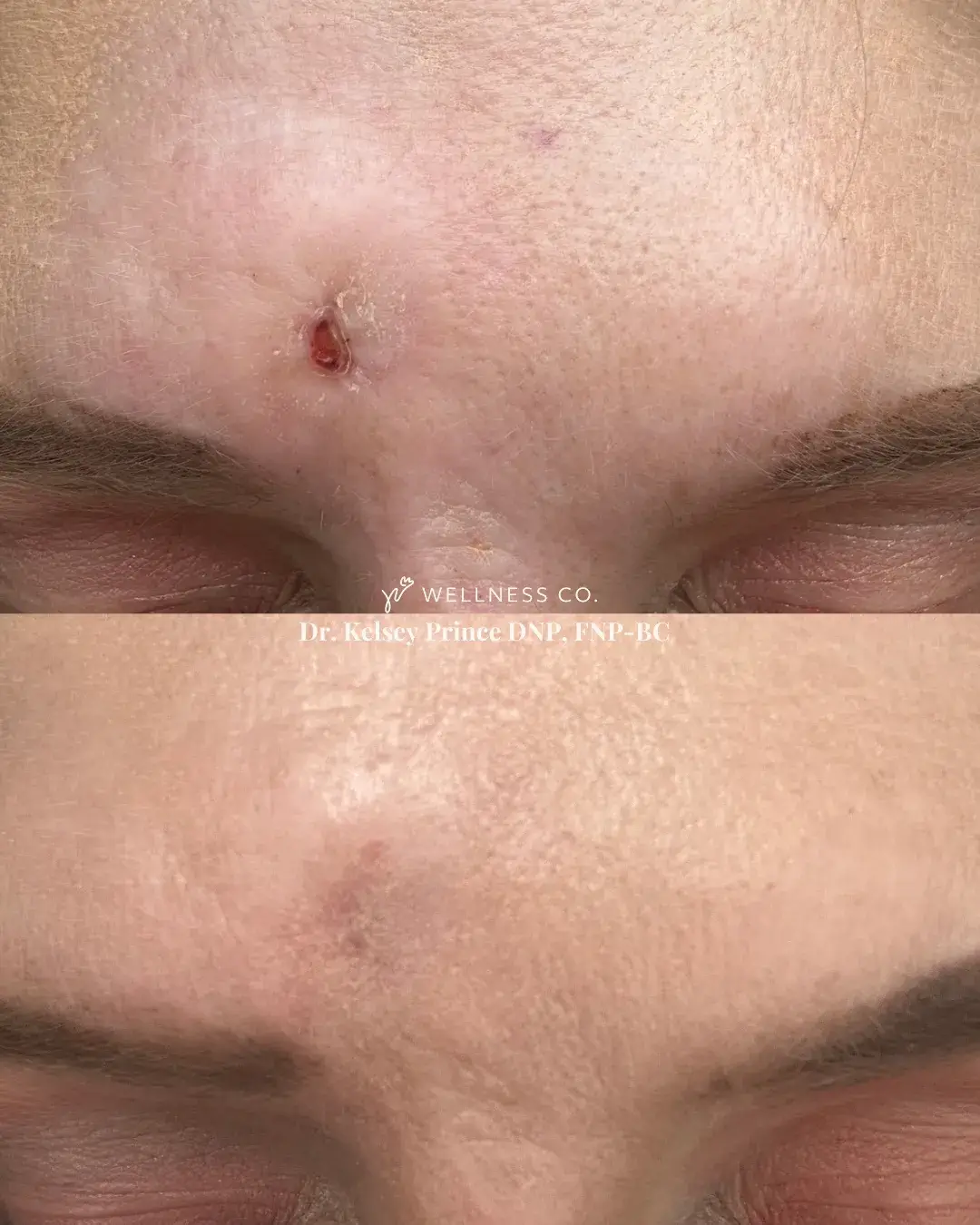 visitwellness-before-after-1.webp