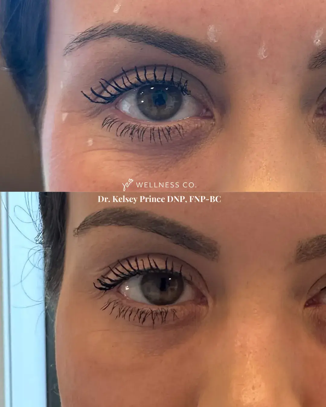 visitwellness-before-after.webp